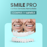 [COMPRÁ 1 Y LLEVÁ 2] Smile Pro® - Carillas Dentales Removibles | Inferior y Superior
