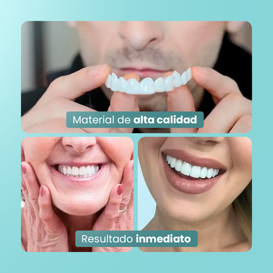 [COMPRÁ 1 Y LLEVÁ 2] Smile Pro® - Carillas Dentales Removibles | Inferior y Superior